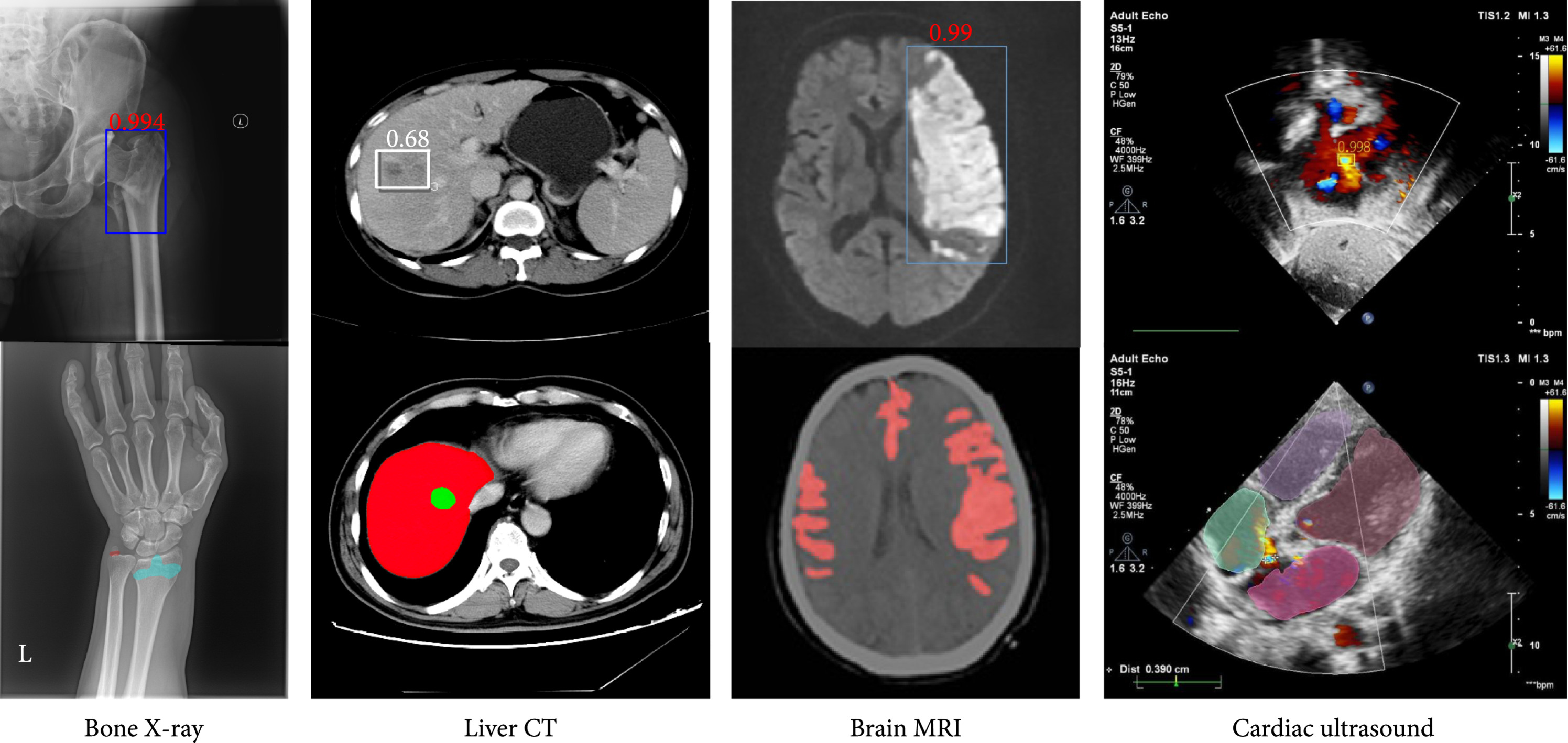 Deep learning for imaging in medicine